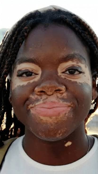 Taking a photo of a skin concern